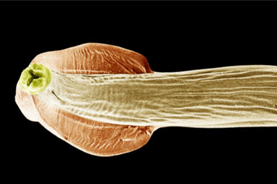 Roundworms | Pets & Parasites: The Pet Owner's Parasite Resource